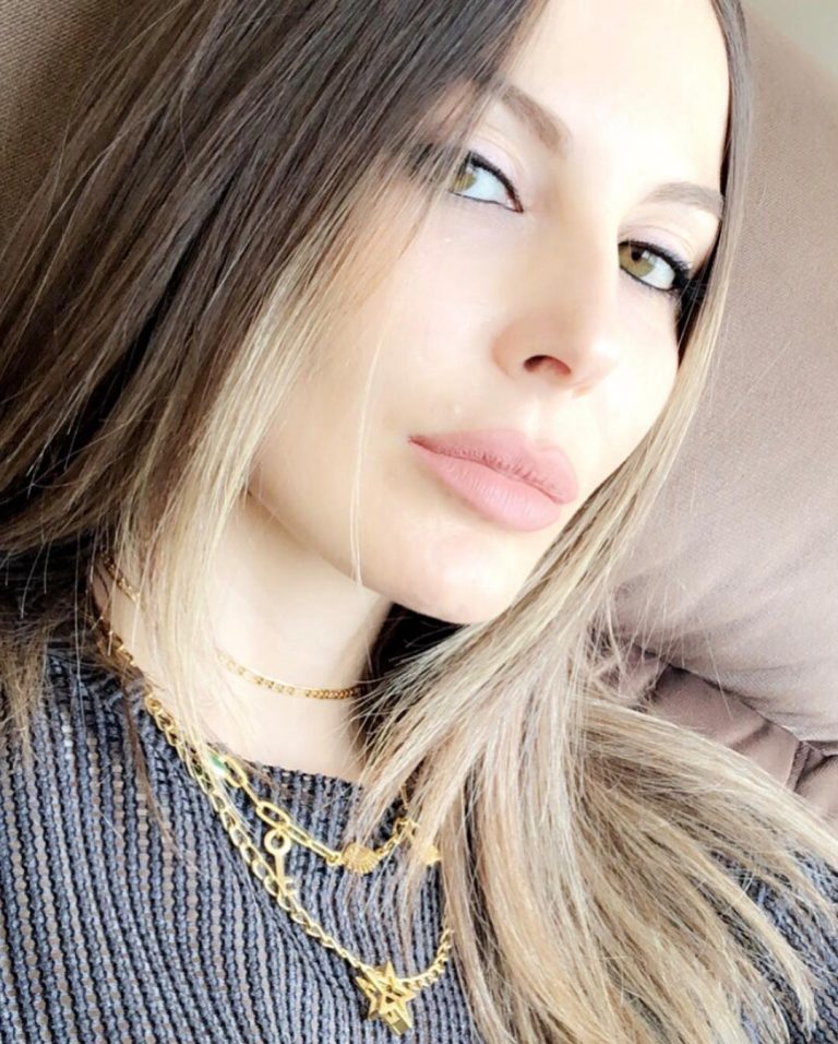 Hande Sarıoğlu kimdir? Sevgilisi kim? Estetiksiz hali?