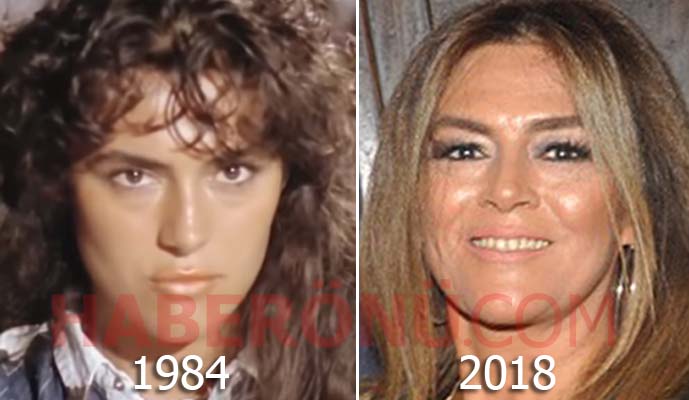 Melike Zobu son hali şimdiki hali 2020