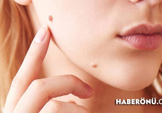 Eczanede satılan et beni ilacı 2025 fiyatları?